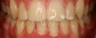 Croppedimage330130 Fangy After