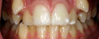Croppedimage330130 Fangy B4