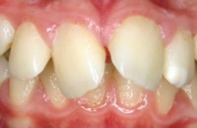 Croppedimage330130 Prominent Teeth Centre B4